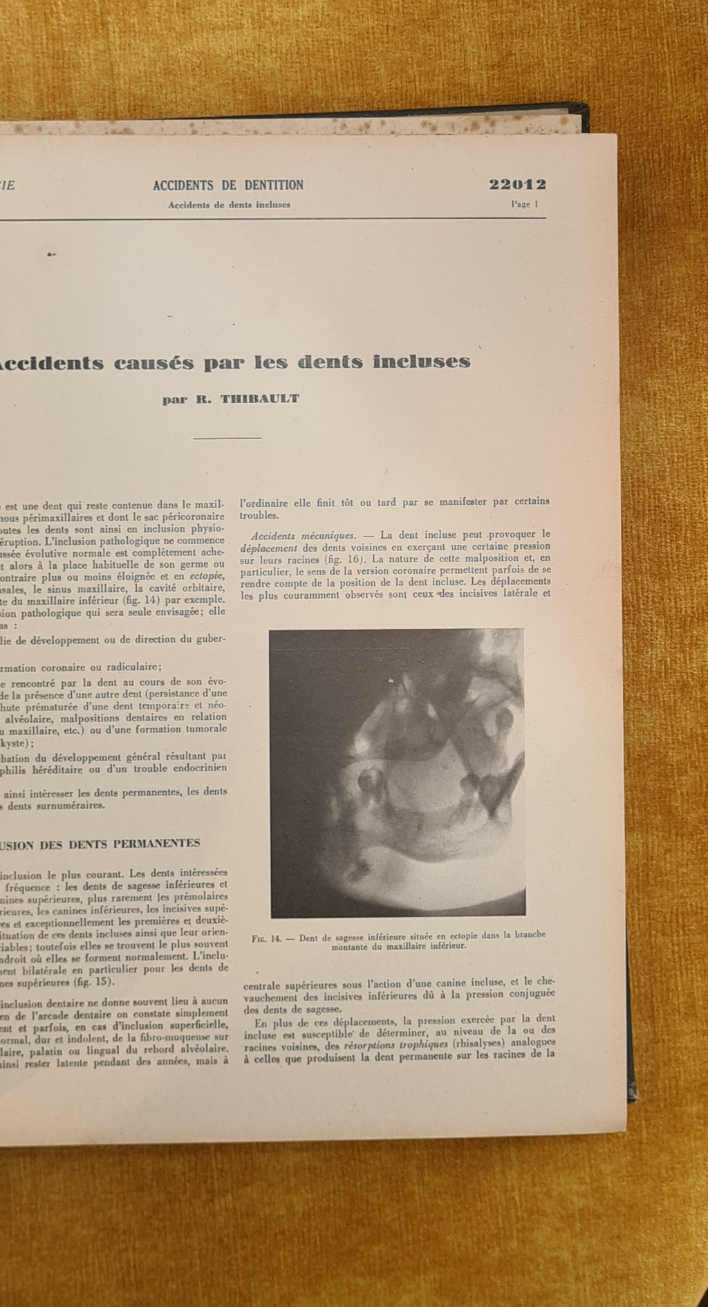 Encyclopédie Médico-Chirurgicale: Stomatologie